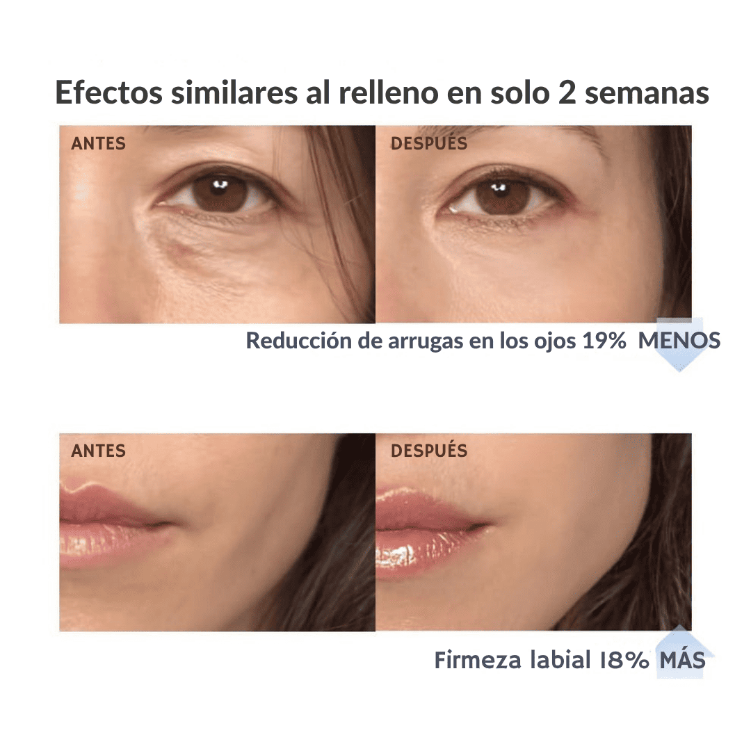 BIÂNCA™ Sérum Voluminizador Coreano