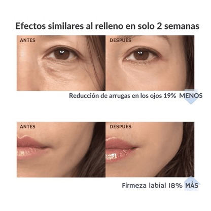 BIÂNCA™ Sérum Voluminizador Coreano