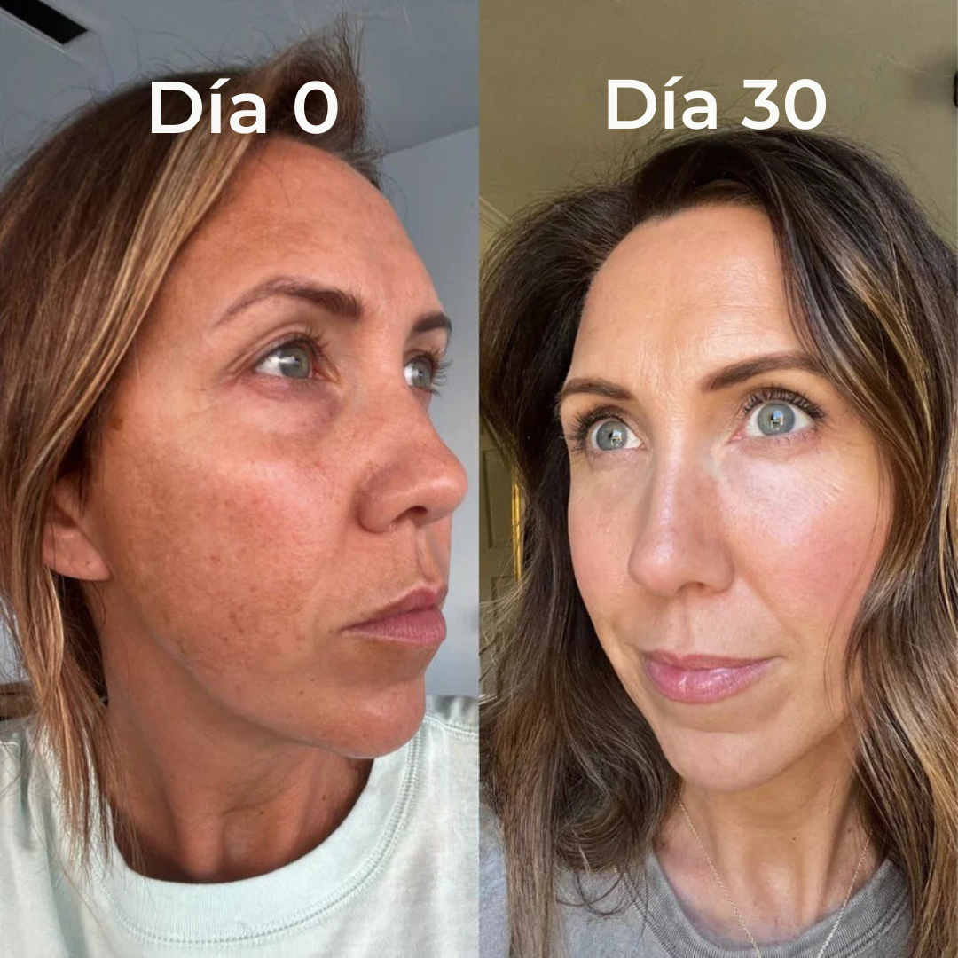 Mascarilla nocturna de cúrcuma y ácido kójico